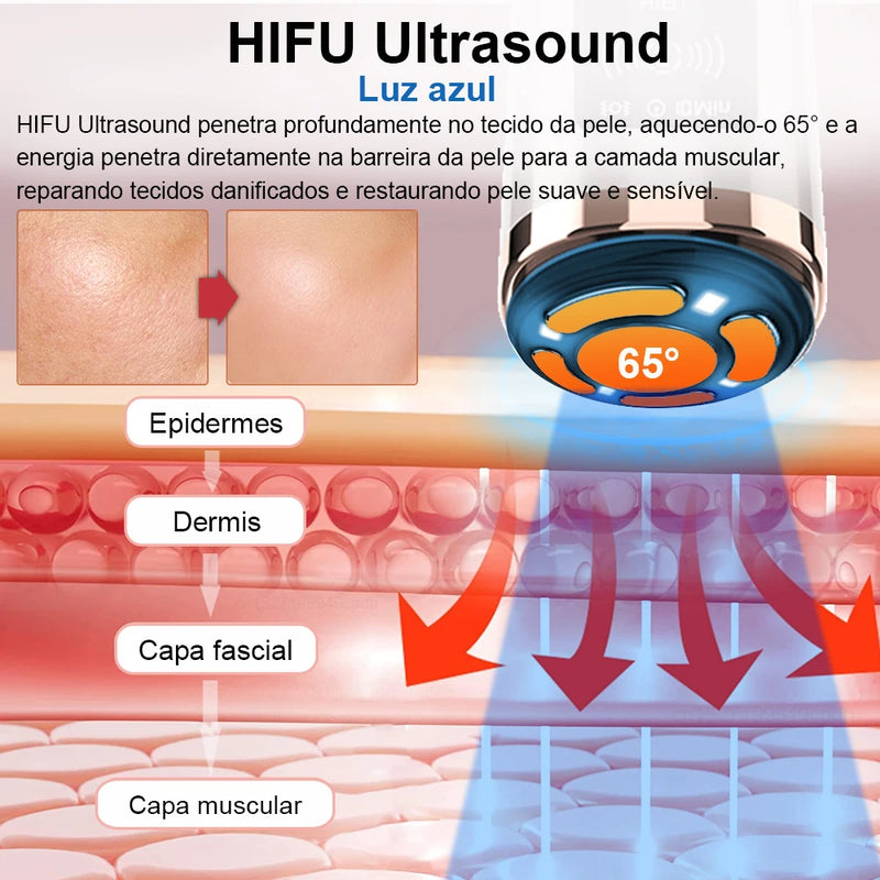 Hifu Maquina anti-envelhecimento